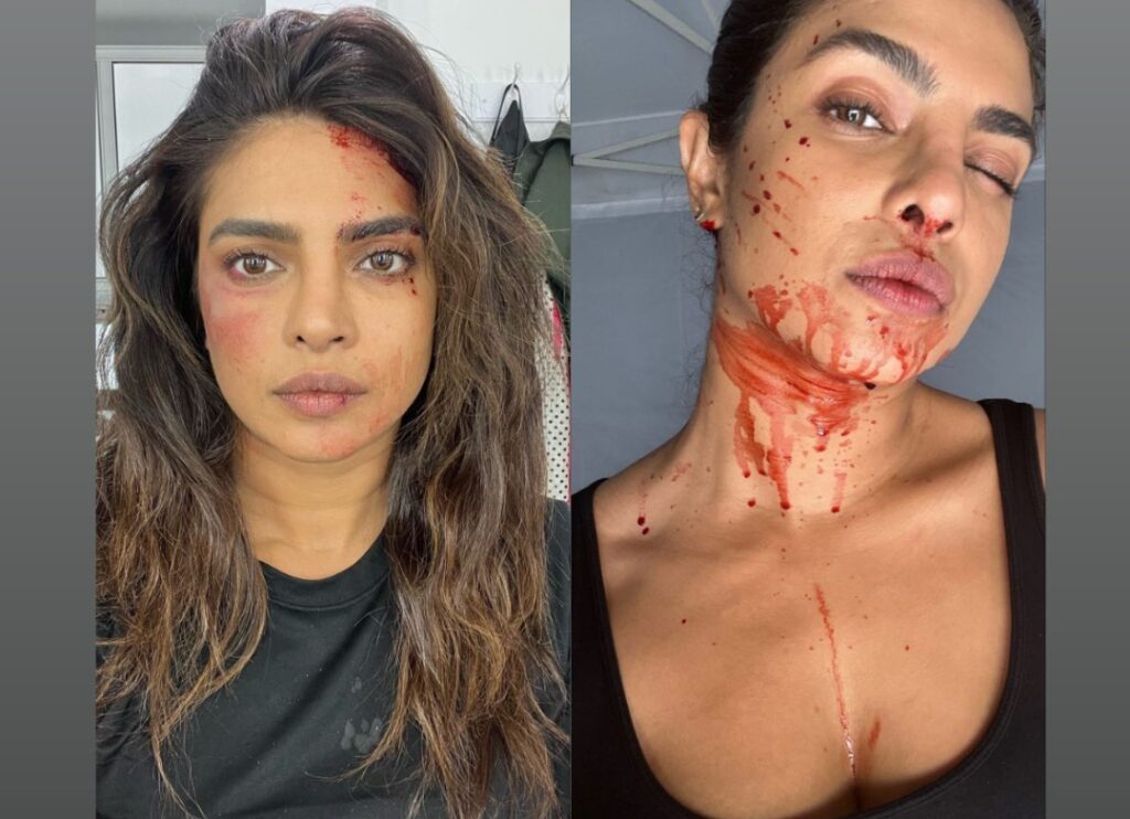 Priyanka Chopra Face Injury: प्रियंका चोपड़ा को आई गंभीर चोट, माथे और मुह से निकल रहा है खून